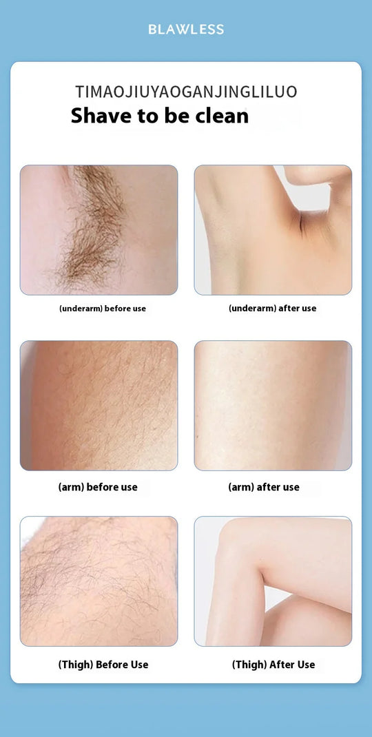 Portable Electric Lady Shaver - Armpit, Bikini, Arm, Leg & Face Hair Removal - Painless