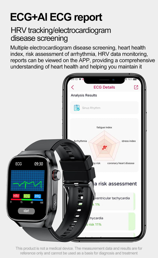 ECG+PPG Health Smartwatch - Heart Rate, Blood Pressure & BT Call Monitor