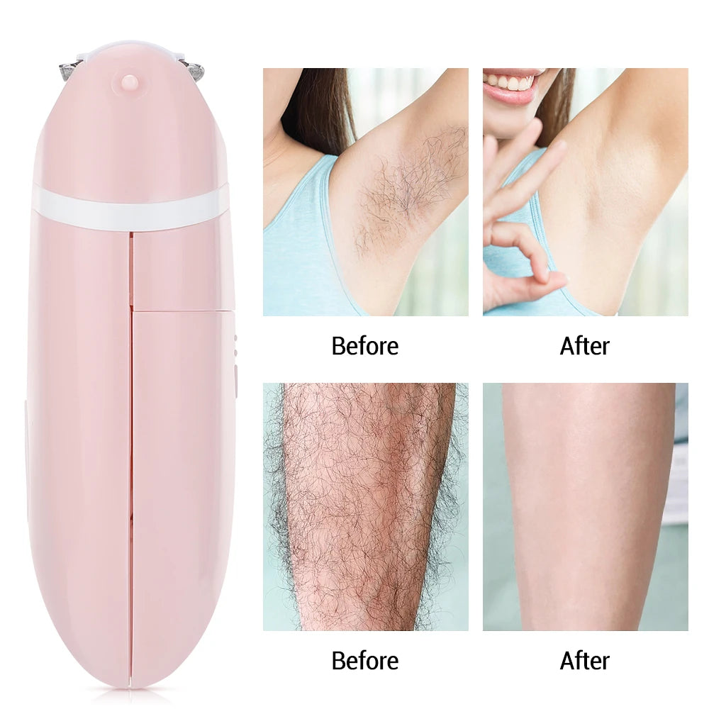 Electric Epilator for Women - Hair Removal for Bikini, Underarm, Leg & Face